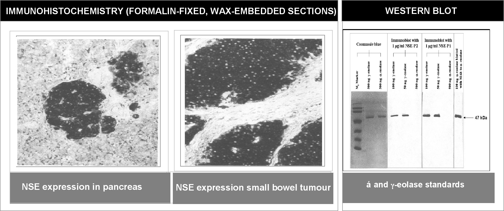 "Left and Center: Immunohistochemical staining of normal pancreas tissue (left) and small bowel tumor tissue (center) using NSE antibody (X2070M and X2071M).
Right: Western blot analysis using NSE antibodies (X2070M and X2071M) on α and γ enolase standards."
